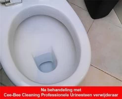 Urinesteen Pakket - Voor Het Verwijderen Van Urinesteen En Het Voorkomen Van Urinesteen - 1x Urinesteenoplosser - 2x Toiletreiniger -Huishoudelijke Schoonmaak 1200x971 1